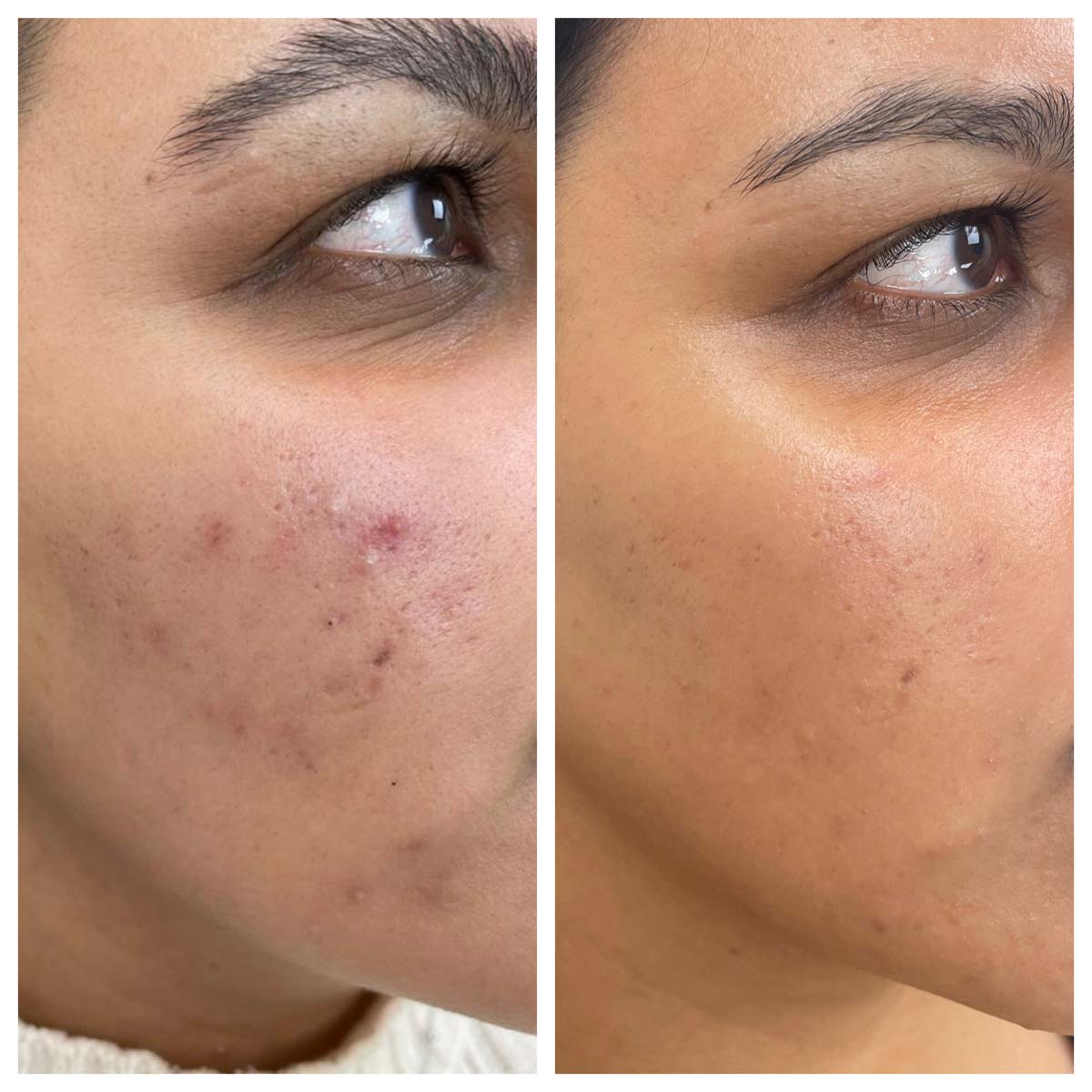 before-after-01